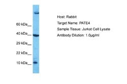 PATE4 Rabbit anti-Human, Polyclonal, Novus Biologicals 0.1ml; Unconjugated:Antibodies,